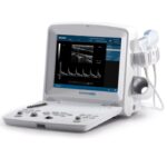 Ecografo eco-doppler portatile DUS 60